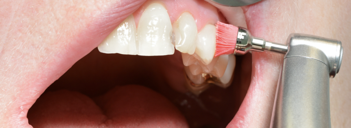Higiene dental Higiene dental