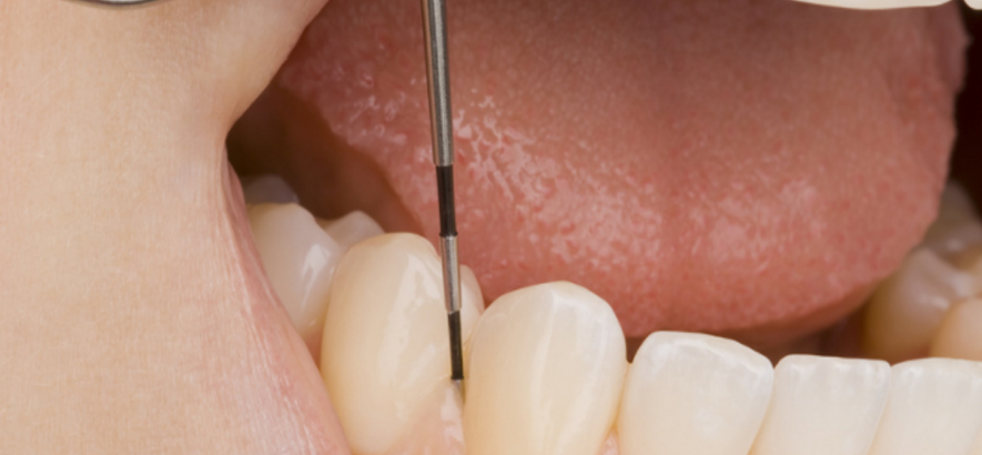 Periodoncia Periodoncia