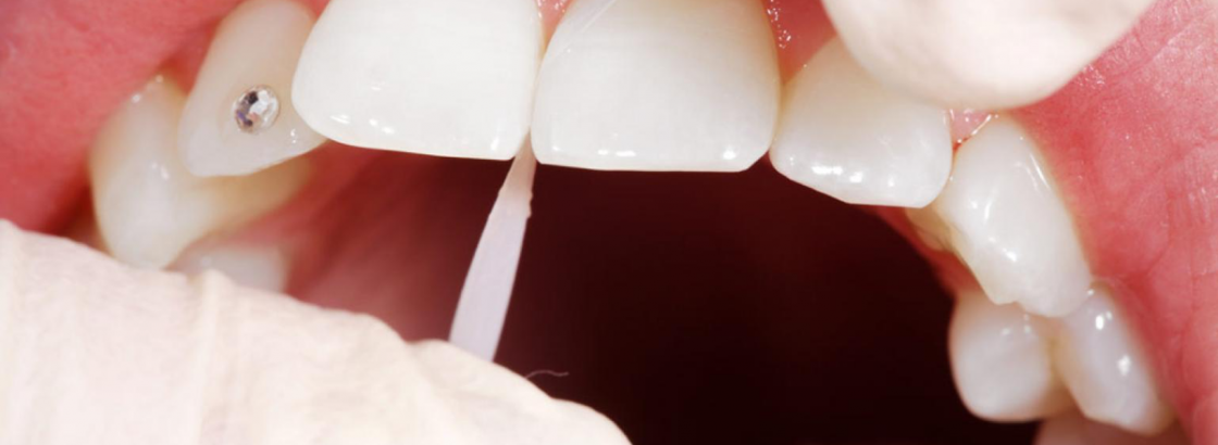 Estética Dental Estética Dental
